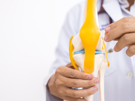 Artrosis de rodilla, manejo kinesiológico artrosis de rodilla, curso artrosis de rodilla
